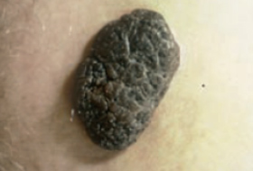 B&eacute;nin 7b