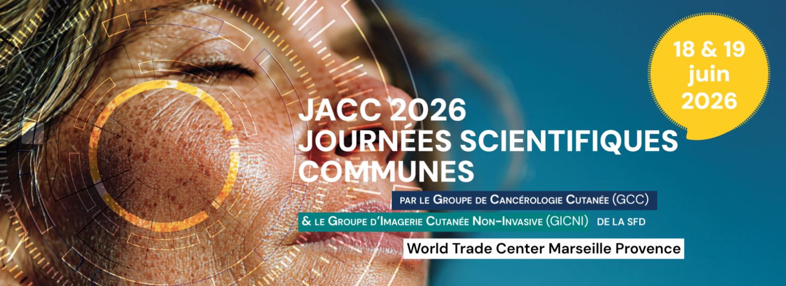 JAcc